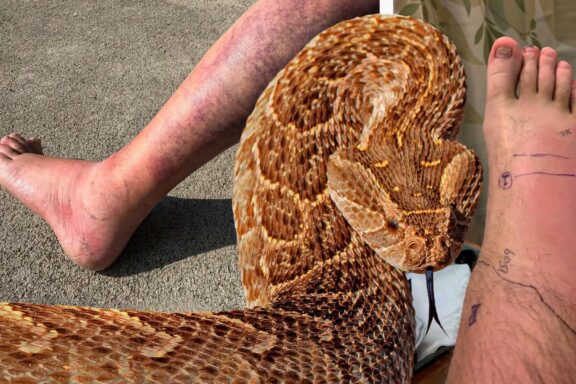 Russell's Viper Symptoms: Bite Warning Signs