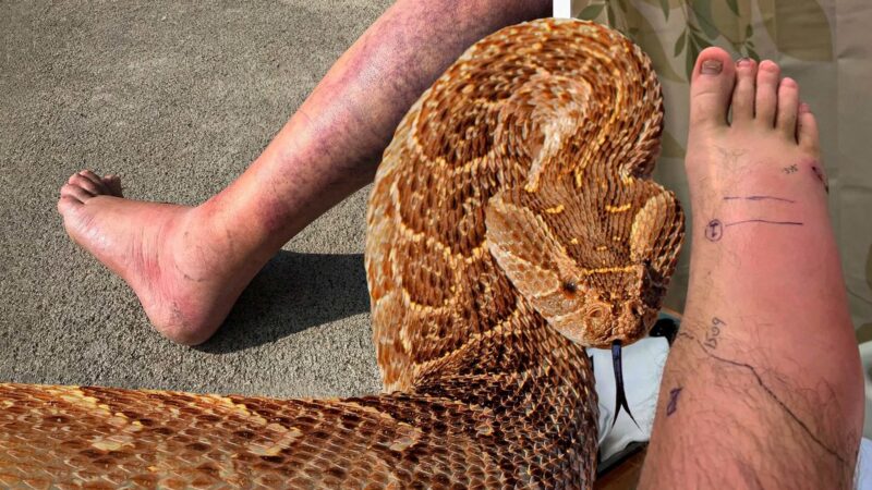 Russell's Viper Symptoms: Bite Warning Signs